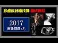 【診療放射線技師国家試験】 2017画像問題 (3)