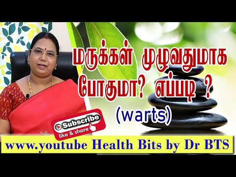 warts ( மருக்கள்) ஏன் வருகிறது? வகைகள் யாவை? வராமல் தடுக்க என்ன செய்ய வேண்டும்? Types, & prevention/