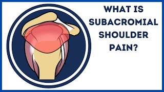 What is subacromial shoulder pain