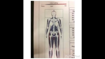 Dexa scan results