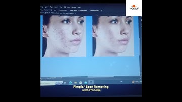 Spot/Removing with Spot healing and Healing brush tool in Adobe Photoshop. #design #graphicdesign