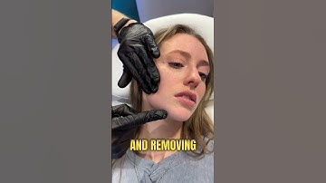 Use these injection points to minimise jowls!