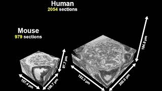 Comparison of glomerular volumes between a mouse and an individual with IgA nephropathy