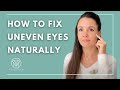 How to fix uneven eyes Naturally
