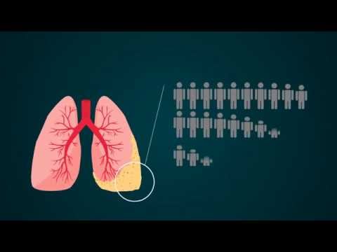 ¿asbesto-en-casa?-sepa-detectarlo-y-protéjase-|-abogados-de-asbestos-y-mesotelioma-|-abogados.com