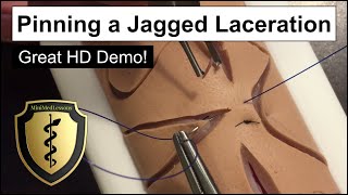 SUTURE Tutorial: Vertical Mattress Pinning Jagged Laceration - Step-by-step instructions!