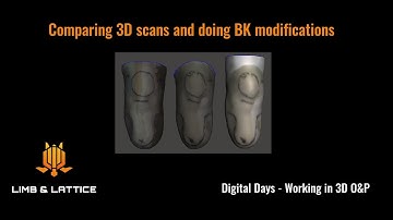 Digital Days - Comparing 3D scans and doing BK suction socket modifications