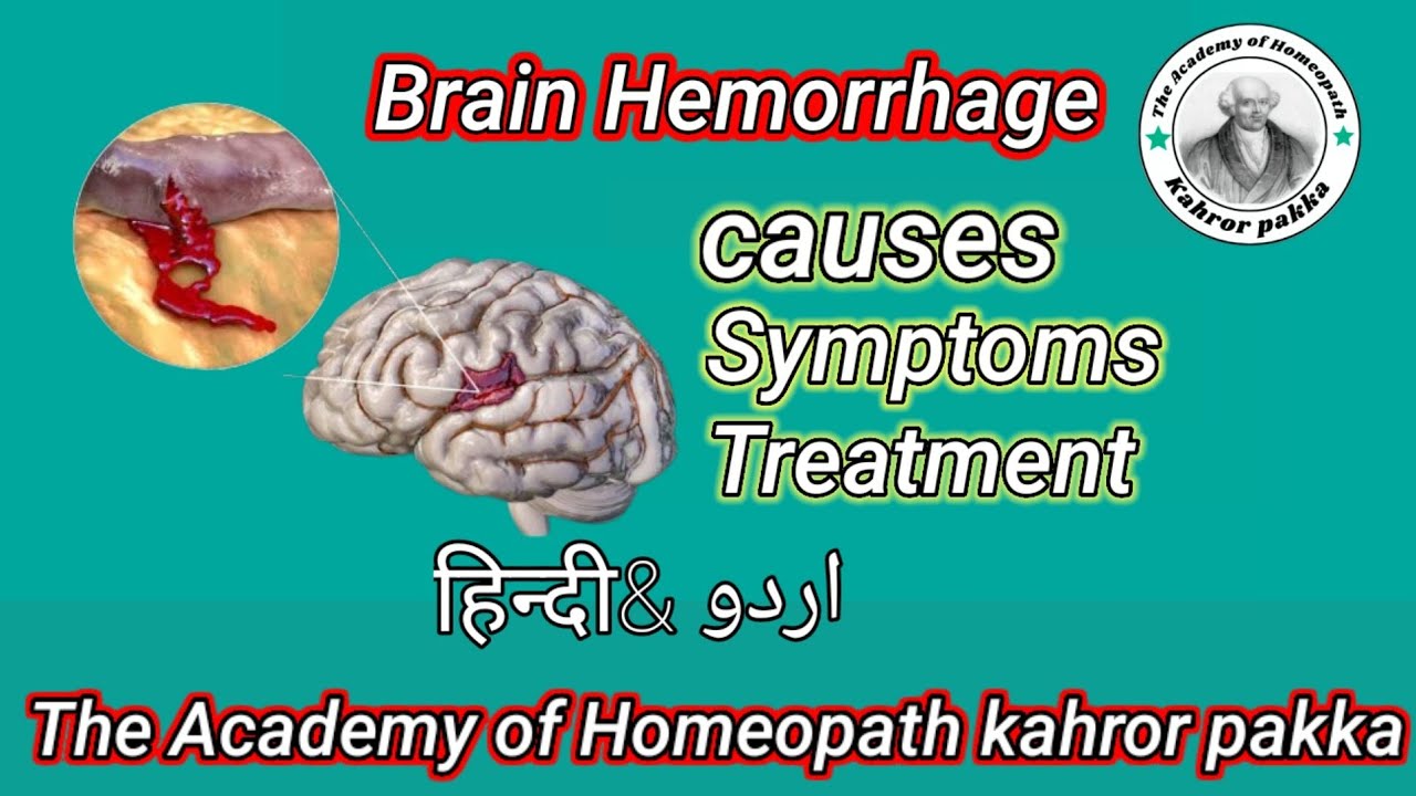 Brain Hemorrhage Causes Symptoms Treatment Urdu And Hindi The 