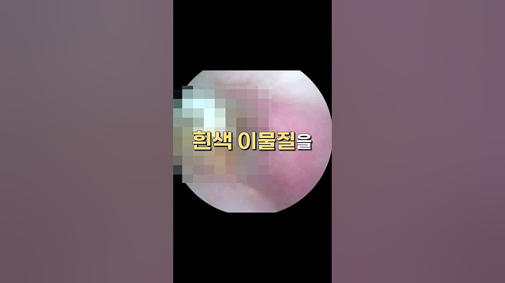 청력을 잃은 남성의 귀에서 발견된 이물질