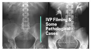IVP Filming & some pathological cases screenshot 5