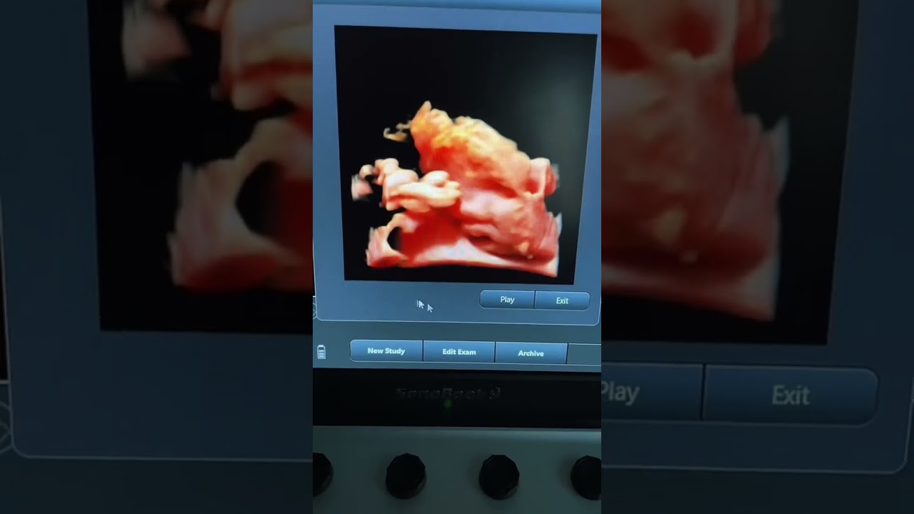 2D vs 3D vs 4D Ultrasounds in Pregnancy | What’s the Difference? 