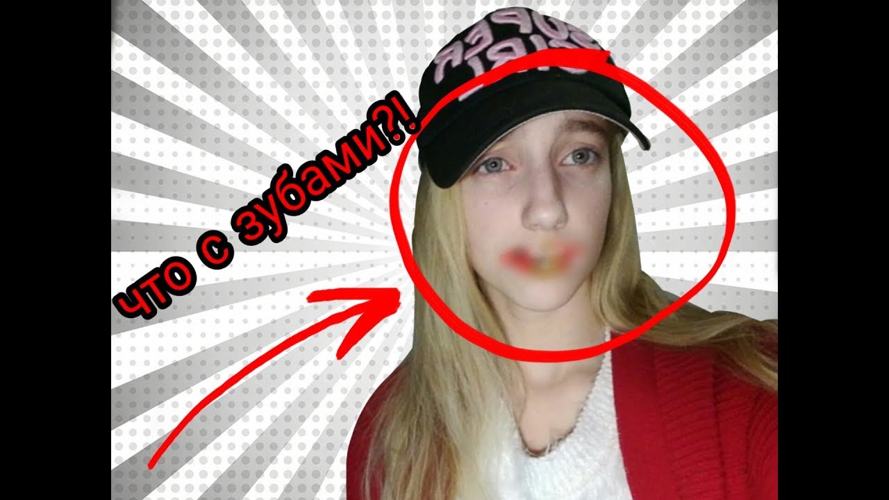 БОЮСЬ СТОМАТОЛОГОВ | ДЕНТОФОБИЯ - YouTube