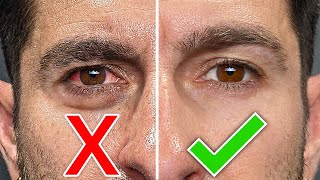 MORE ATTRACTIVE EYES in 3 DAYS! (6 Tricks to Fix Dark Circles, Eye Bags, Red Eyes FAST) screenshot 4