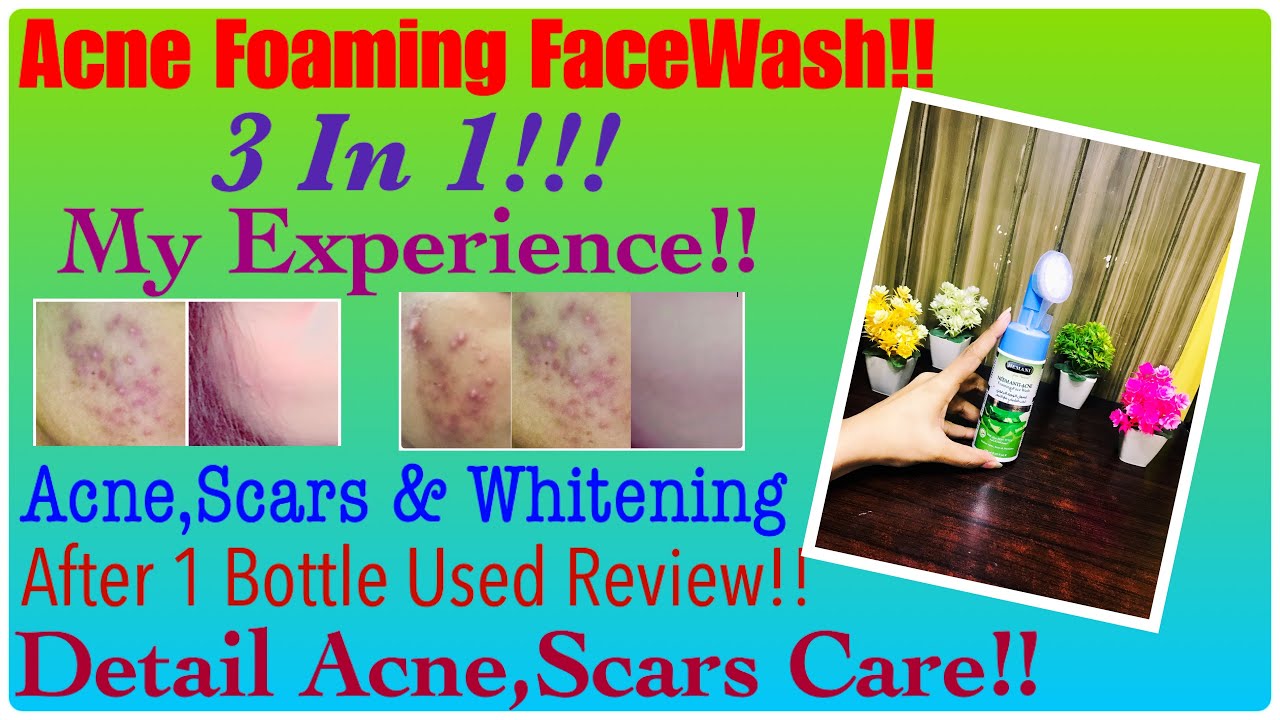 Hemani Neem Acne Foaming Face Wash 3 In 1 Acne,Scars & Whitening