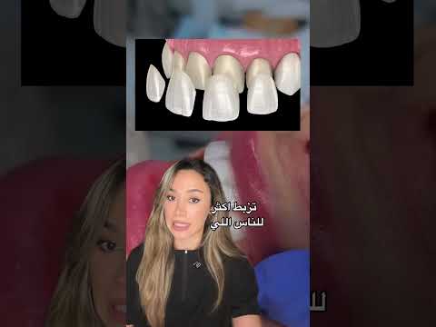 فينيرز مختلف اكسبلور اسنان 