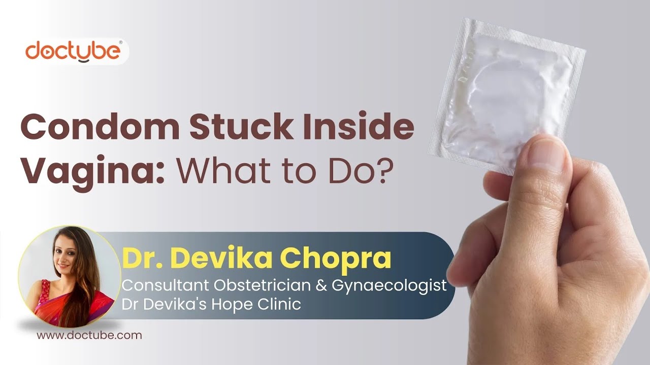 Don't Let This Happen to You! What to Do When a Condom Gets Stuck - YouTube