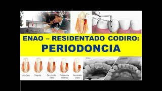 ENAO - RESIDENTADO ODONTOLÓGICO: PERIODONCIA