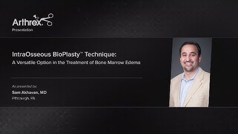 IntraOsseous BioPlasty™ Technique: A Versatile Option in the Treatment of Bone Marrow Edema