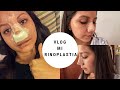 ¿ME OPERÉ LA NARIZ? | Vlog día a día de mi rinoplastia | Kelly Zevallos