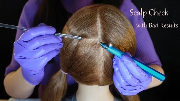 ASMR Scalp Check with Bad Results (Lots of Whispering)