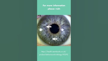 An introduction to the Behavioural Iridology book, with brief iris analysis