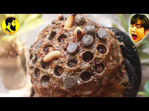 HUGE DANDRUFF FLAKES REMOVAL - How To Remove All Larva Inside Biggest Dandruff Flaky By Hand #224