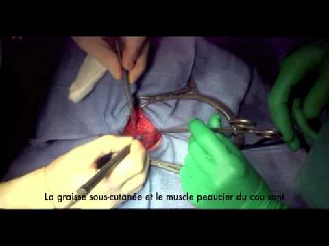 Video: Superieure Schuine Functie, Anatomie En Diagram - Lichaamskaarten