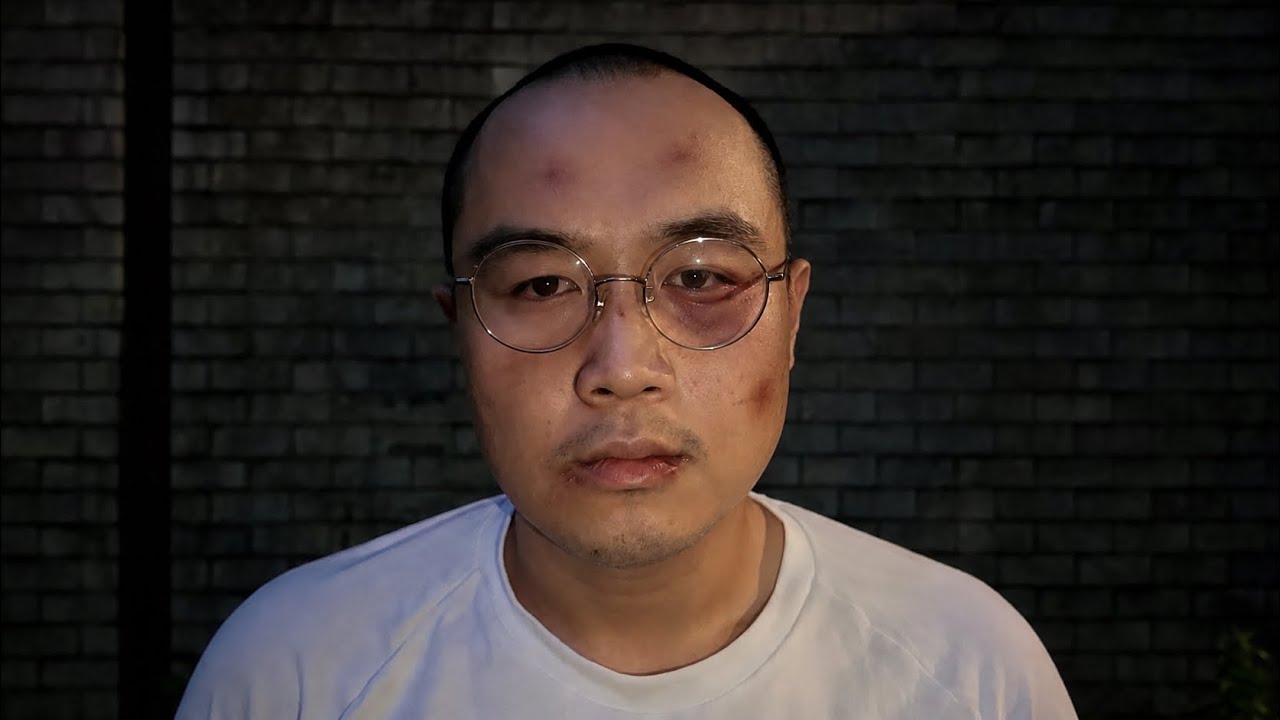 【緊急】親友の600番がとある男にボコボコにされました|Vol.80