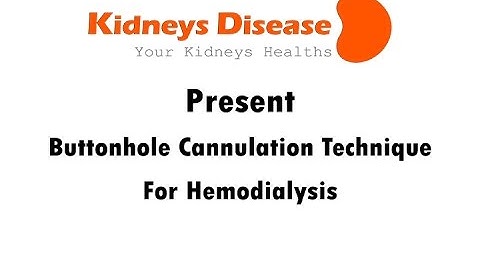 Buttonhole Cannulation Technique For dialysis