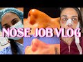 NOSE JOB VLOG  *emotional reveal*  rhinoplasty | Closet Raid