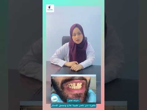 ايش هو الدايركت فينير شوفوا معانا ومع دكتورة ندى ناصر