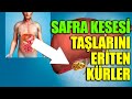 Safra Kesesi Taşından Ameliyatsız 2 Haftada Tamamen Kurtaran KÜR