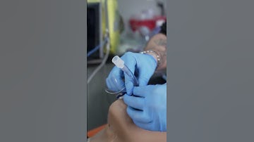 AEC intubation + Ventilations
