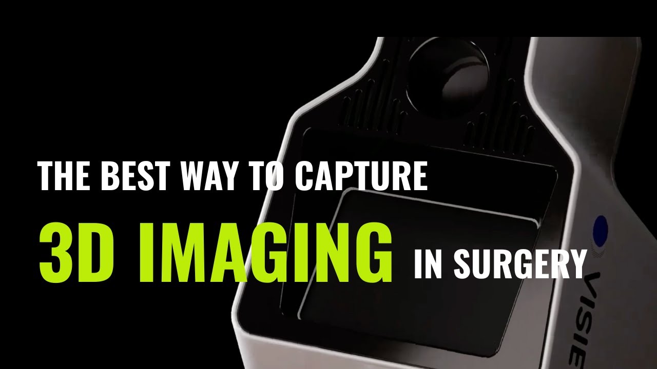 LiDAR vs Stereography vs Structured Light | VISIE Surgical Tech