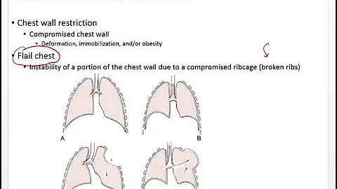 Ch 27 Pulmonary Disorders