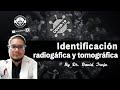 IDENTIFICACIÓN RADIOGRÁFICA Y TOMOGRÁFICA EN COVID 19 // BY DAVID TREJO
