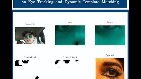 Driver Fatigue Detection System Based on Eye Tracking and Dynamic Template Matching Matlab Project