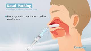 Cenefom Nasal Packing