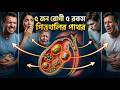 ৫ জন রোগী, ৫ রকম পিত্তথলির পাথর! | Gallstones | Dr Mustafizur Rahman