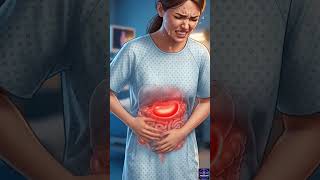 What Happens When Your Appendix Bursts? 😨#Appendix #Appendicitis #MedicalFacts #HealthEducation