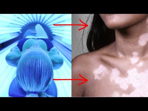 Нашли Способ? Пятен после Солярия Больше Не Будет?