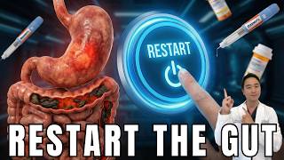 The GLP-1 Digestion Fix: How to "Un-Paralyze" Your Gut