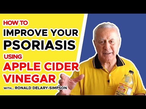 Apple Cider Vinegar for Psoriasis