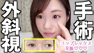 斜視の手術をする事になりました！【コンプレックス】
