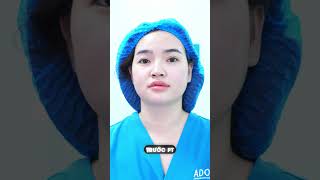 Dáng mũi này là kiểu visual Hàn đang hot #adona #nangmui #catmi #viralshortsvideo