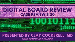 Digital Board Review | Cases 1-20