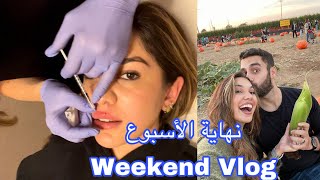 Weekend Vlog| فلوق نهاية الأسبوع نفخت شفايفي لأول مره😱