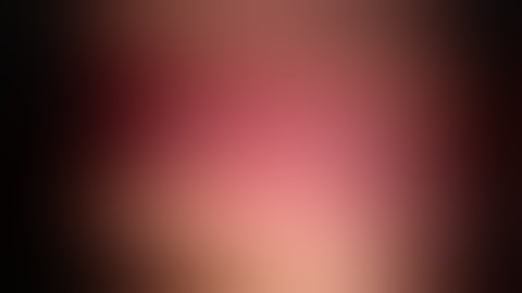 Robotic Lobectomy Port Placement