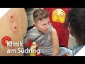 Komische Pusteln: Was für eine seltene Krankheit hat Tobias (12)? 😳 | Klinik am Südring | SAT.1