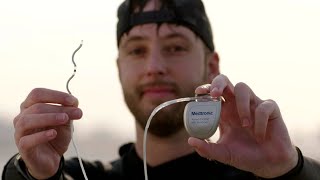 Harrison's story: Living with the Medtronic EVICD™ system